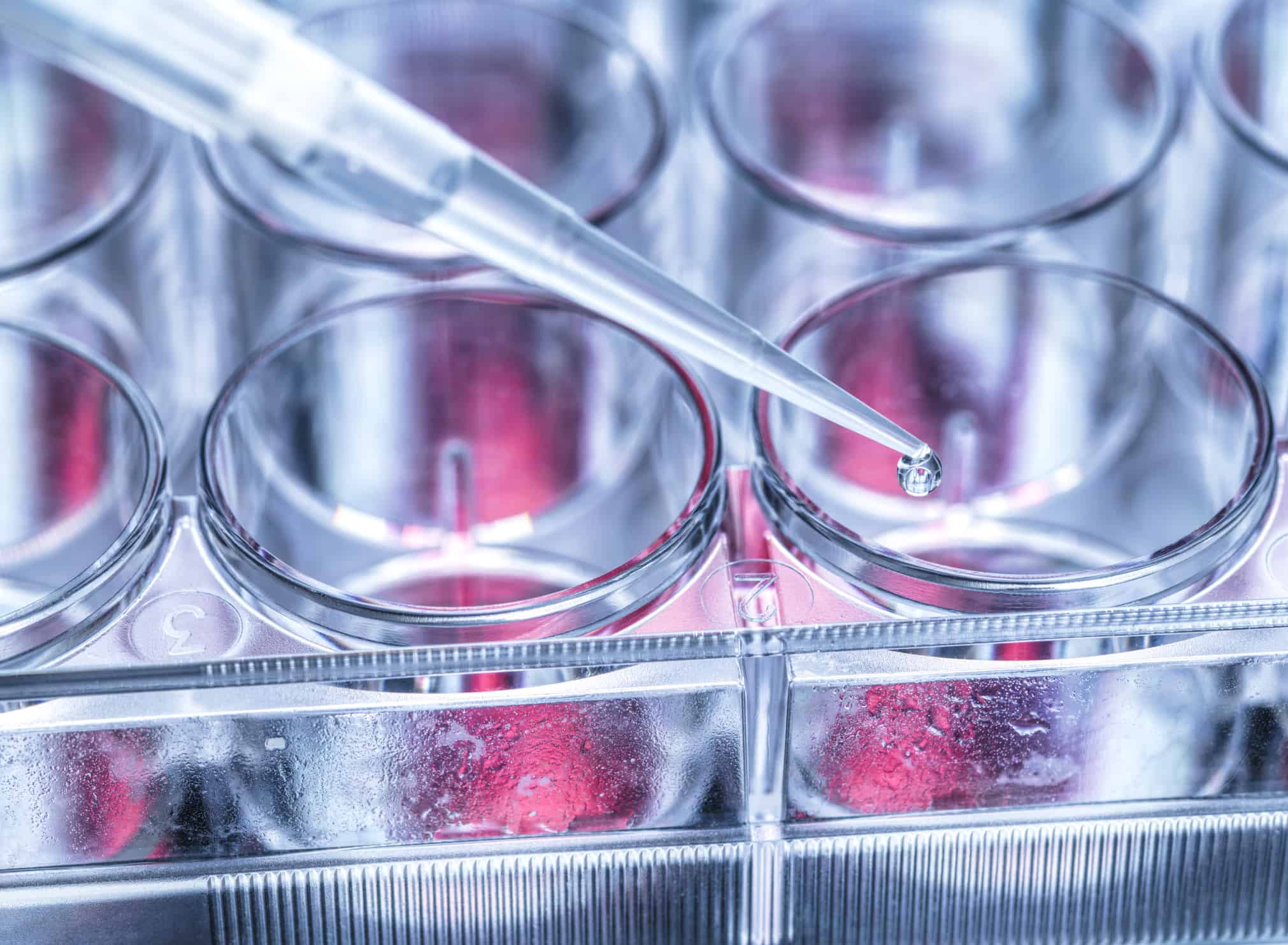 GettyImages 1294915150 Is Bellus Health Stock Still a Buy After 30% Earnings Jump?